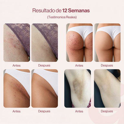 GOZE — Roll-On Corporal para Granitos y Marcas