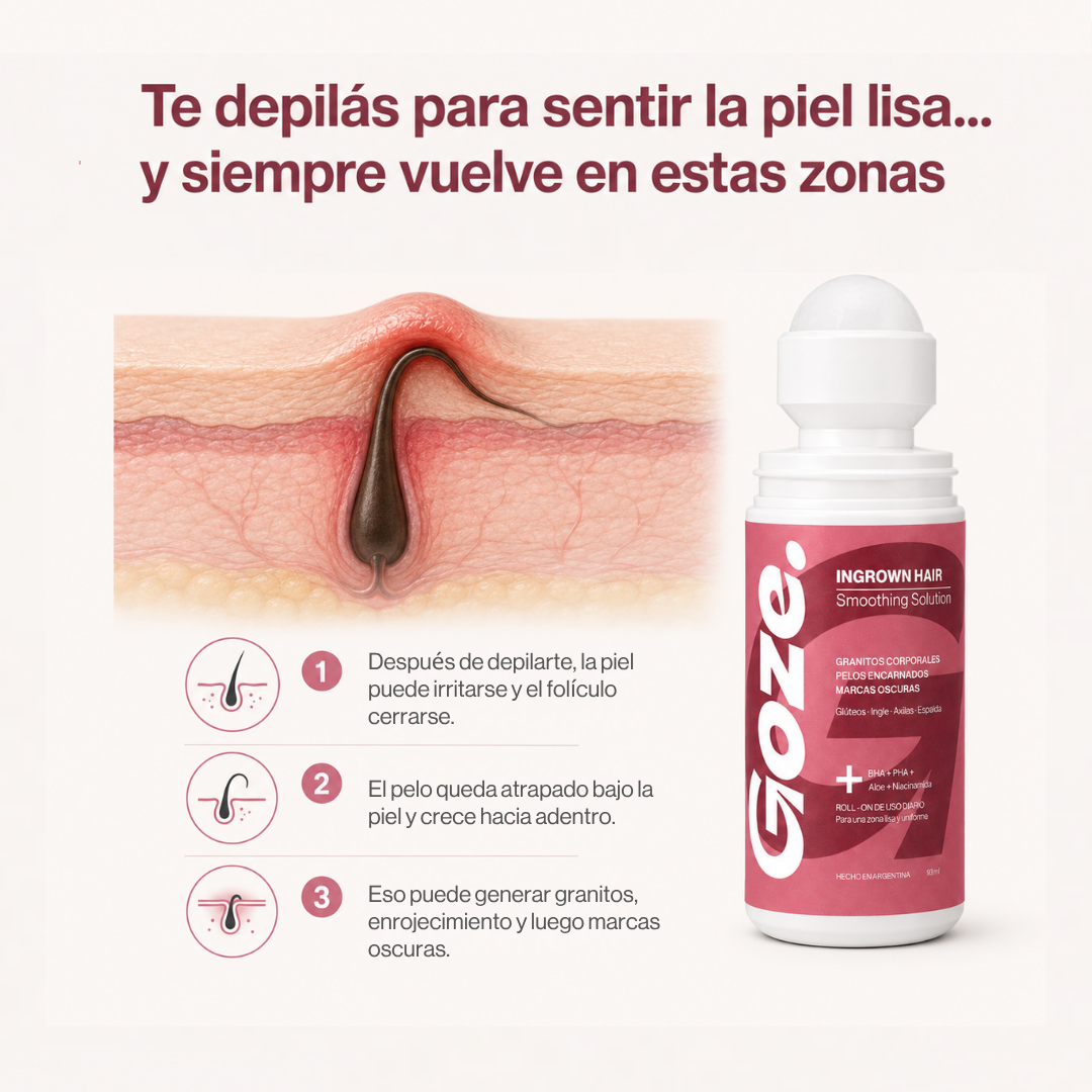 GOZE — Roll-On Corporal para Granitos y Marcas