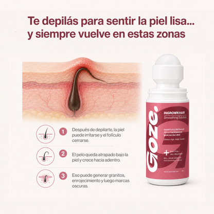 GOZE — Roll-On Corporal para Granitos y Marcas