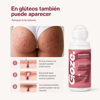 GOZE — Roll-On Corporal para Granitos y Marcas