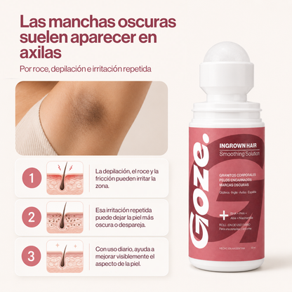 GOZE — Roll-On Corporal para Granitos y Marcas