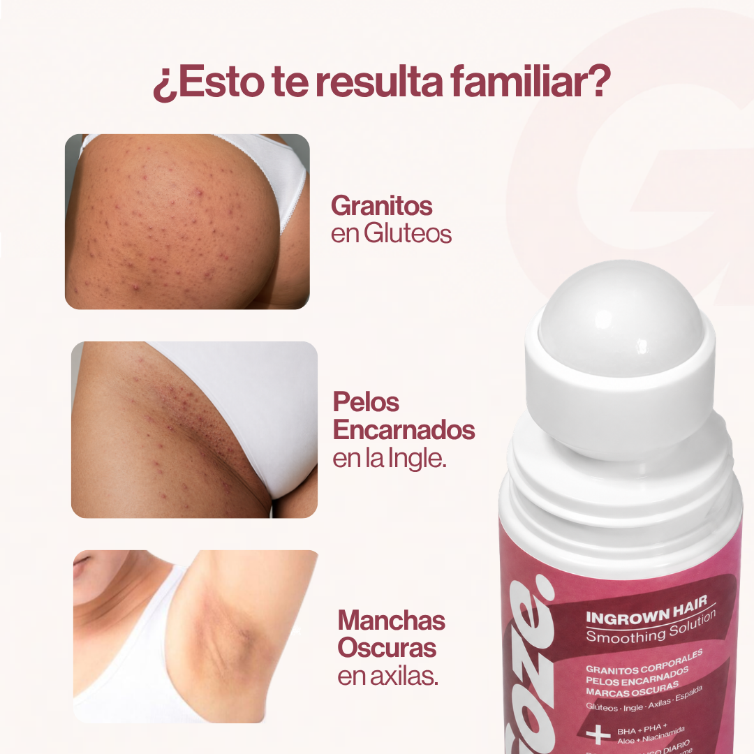 GOZE — Roll-On Corporal para Granitos y Marcas